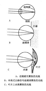 ����γ�ԭ��ʾ��D